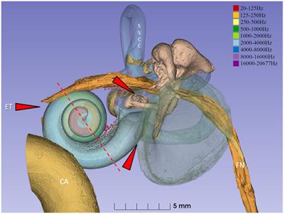 Immuno-surveillance and protection of the human cochlea